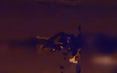 Giresun’da sokak köpeği saldırısı: Kadın boğazından ağır yaralandı