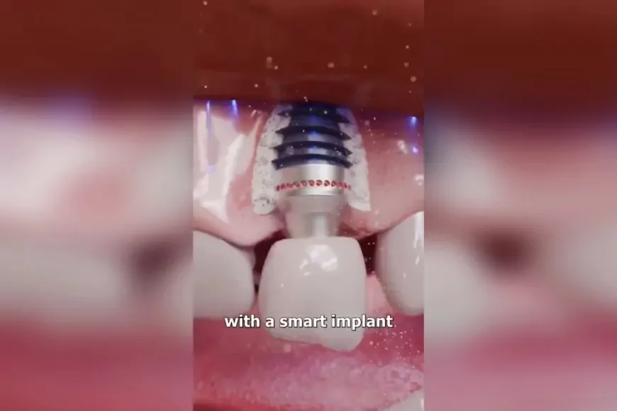 Akıllı Diş İmplantlarıyla Ağız Sağlığında Yeni Dönem Başlıyor